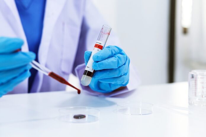 Scientist holding Coronavirus covid-19 infected blood sample tub